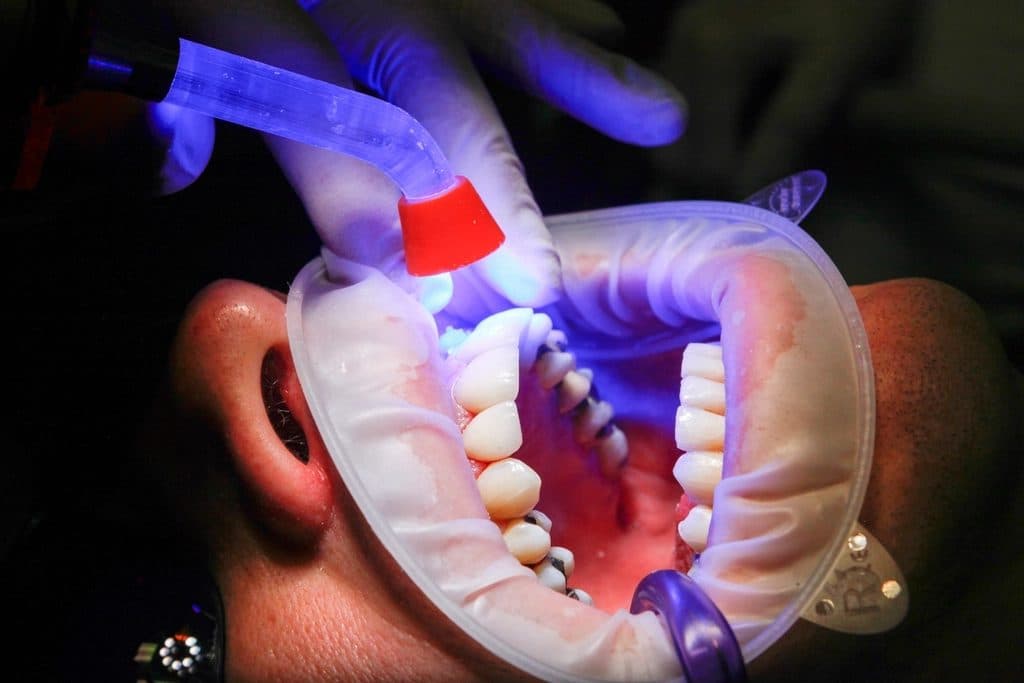 Precise dental treatment